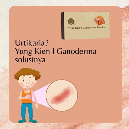 Urtikaria (ruam gatal) adalah kondisi kulit yang ditandai dengan munculnya bentol merah yang terasa gatal, terkadang disertai sensasi panas atau terbakar.